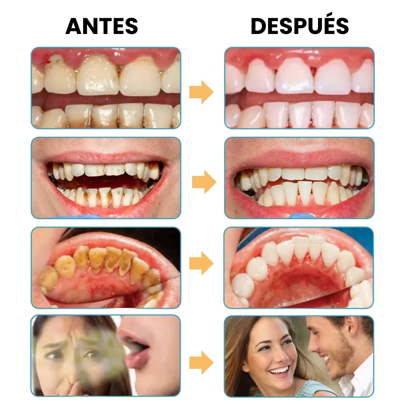 IRRIGADOR DENTAL