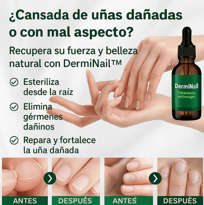 DermiNail ELYON™ – TRATAMIENTO ANTI HONGOS 7 DÍAS 100% NATURAL