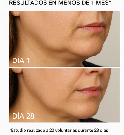 Tratamiento Cuello Rejuvenecido