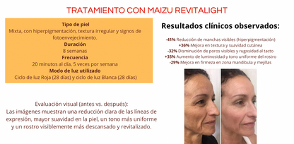 TERÁPIA DE LUZ ROJA