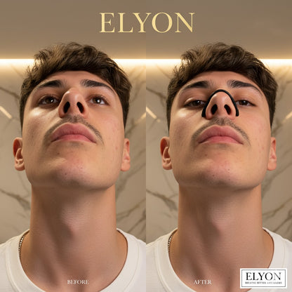 ELYON™ V2 ELYON™ V2 Tiras nasales magnéticas